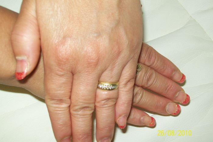 100_9174.JPG